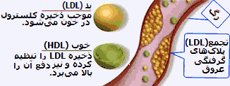 HDL-LDL